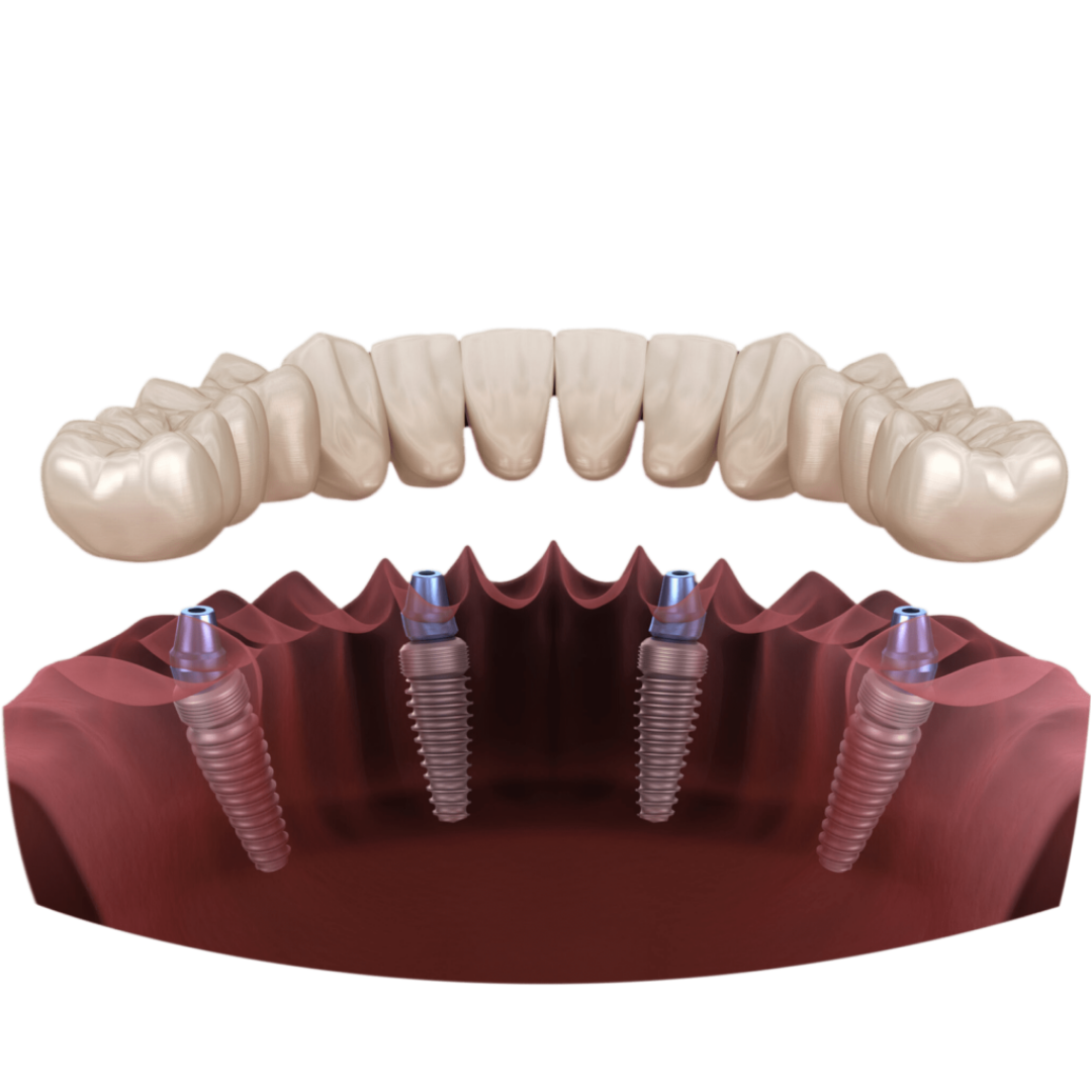 Ağız Diş ve Çene Cerrahisi