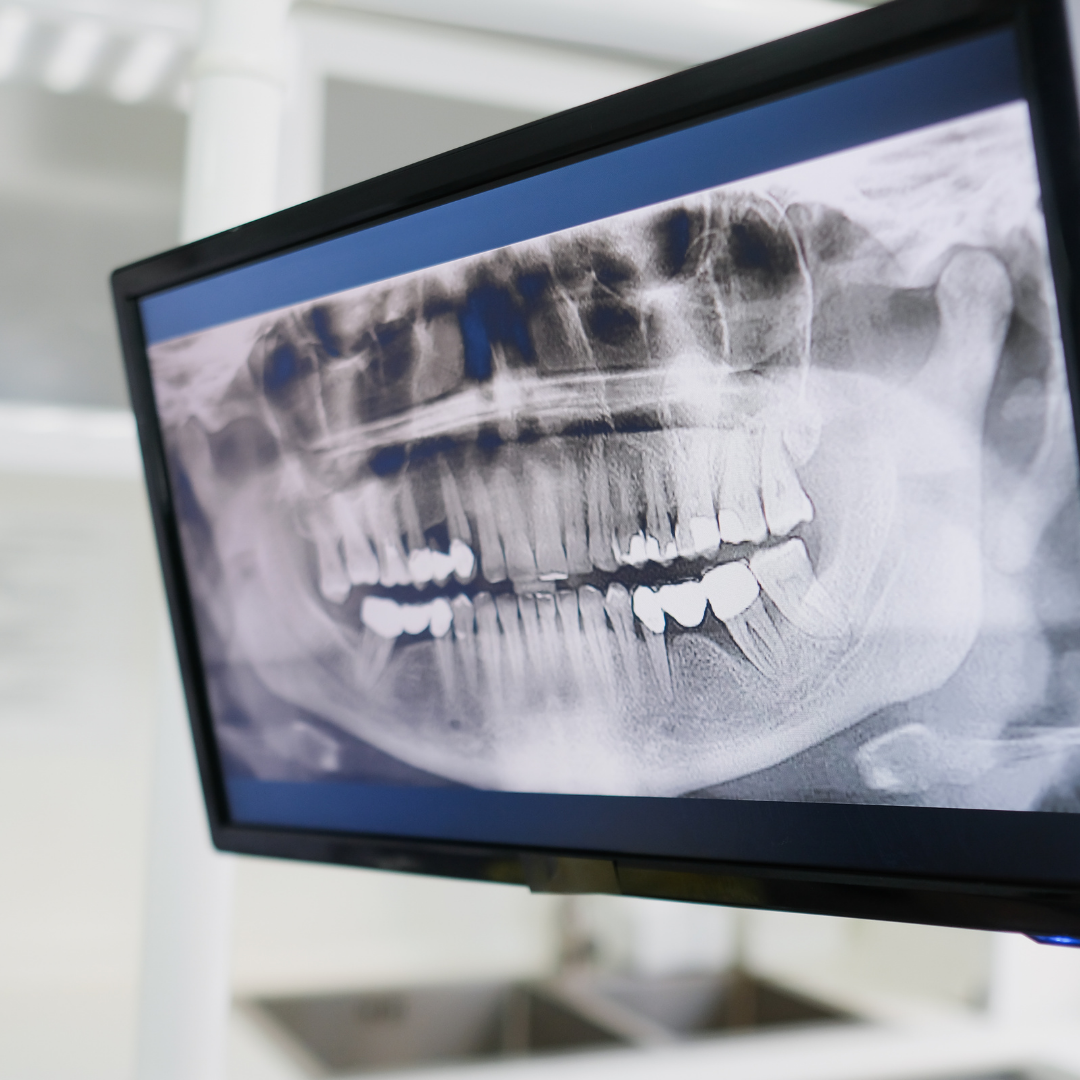 Röntgen ve Görüntüleme